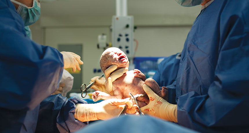 Doctors, woman lost baby, Newly born baby, Cesarean delivery, C-section, Jodhpur, Jodhpur hospital