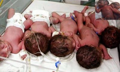 Woman, Seven babies, Woman delivers seven babies, Youssef Fadl, Septuplet birth, Newborn babies, Iraq, World news