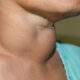Thyroid Awareness Month 2024